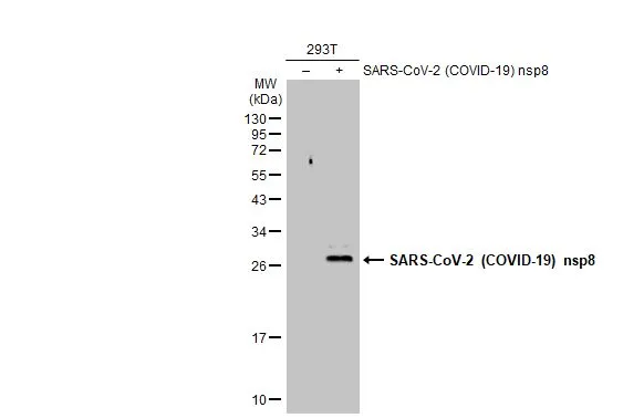 Non-transfected (–) and transfected (+) 293T whole cell extracts (30 μg) were separated by 12% SDS-PAGE, and the membrane was blotted with SARS-CoV-2 (COVID-19) nsp8 antibody (GTX135729) diluted at 1:5000. The HRP-conjugated anti-rabbit IgG antibody (GTX213110-01) was used to detect the primary antibody. Non-transfected (–) and transfected (+) 293T whole cell extracts (30 μg) were separated by 12% SDS-PAGE, and the membrane was blotted with SARS-CoV-2 (COVID-19) nsp8 antibody (GTX135729) diluted at 1:5000. The HRP-conjugated anti-rabbit IgG antibody (GTX213110-01) was used to detect the primary antibody.