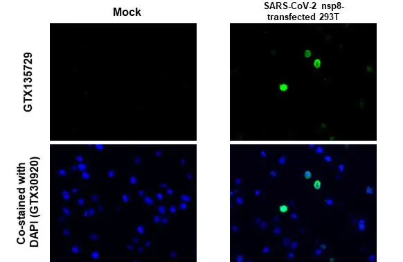 SARS-CoV-2 (COVID-19) nsp8 antibody detects SARS-CoV-2 (COVID-19) nsp8 protein at cytoplasm by immunohistochemical analysis. Sample: Mock (GTX435670) and SARS-CoV-2 (COVID-19) nsp8 transfected 293T cell FFPE Cell Pellet Block. Green: SARS-CoV-2 (COVID-19) nsp8 stained by SARS-CoV-2 (COVID-19) nsp8 antibody (GTX135729) diluted at 1:1000. Blue: Fluoroshield with DAPI (GTX30920). Antigen Retrieval: Citrate buffer, pH 6.0, 15 min