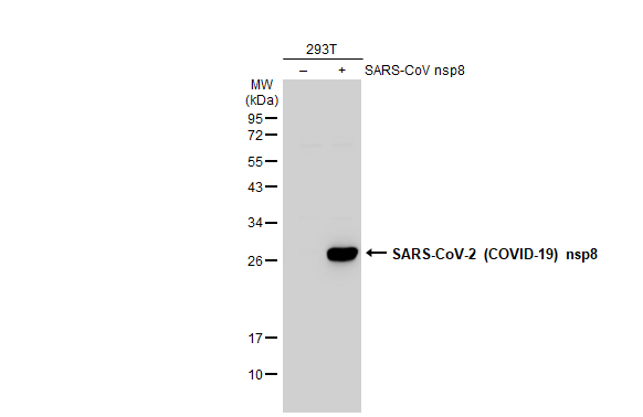 Non-transfected (-) and transfected (+) 293T whole cell extracts (30 microg) were separated by 12% SDS-PAGE, and the membrane was blotted with SARS-CoV-2 (COVID-19) nsp8 antibody (GTX135730) diluted at 1:5000. The HRP-conjugated anti-rabbit IgG antibody (GTX213110-01) was used to detect the primary antibody.