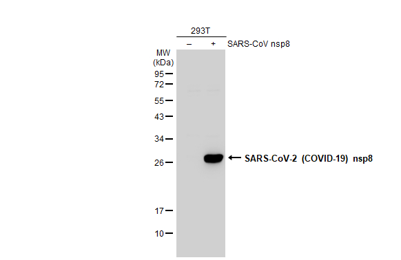 Non-transfected (–) and transfected (+) 293T whole cell extracts (30 μg) were separated by 12% SDS-PAGE, and the membrane was blotted with SARS-CoV-2 (COVID-19) nsp8 antibody (GTX135730) diluted at 1:5000. The HRP-conjugated anti-rabbit IgG antibody (GTX213110-01) was used to detect the primary antibody.