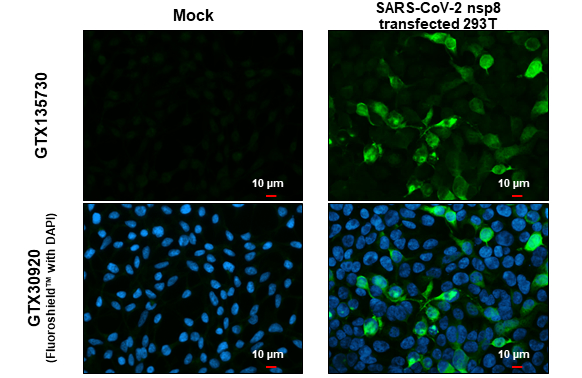 SARS-CoV-2 (COVID-19) nsp8 antibody detects SARS-CoV-2 (COVID-19) nsp8 protein at cytoplasm by immunofluorescent analysis. Sample: Mock and transfected transfected 293T cells were fixed in 4% paraformaldehyde at RT for 15 min. Green: SARS-CoV-2 (COVID-19) nsp8 stained by SARS-CoV-2 (COVID-19) nsp8 antibody (GTX135730) diluted at 1:2000.