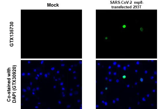 SARS-CoV-2 (COVID-19) nsp8 antibody detects SARS-CoV-2 (COVID-19) nsp8 protein at cytoplasm by immunohistochemical analysis. Sample: Mock (GTX435670) and SARS-CoV-2 (COVID-19) nsp8 transfected 293T cell FFPE Cell Pellet Block. Green: SARS-CoV-2 (COVID-19) nsp8 stained by SARS-CoV-2 (COVID-19) nsp8 antibody (GTX135730) diluted at 1:1000. Blue: Fluoroshield with DAPI (GTX30920). Antigen Retrieval: Citrate buffer, pH 6.0, 15 min