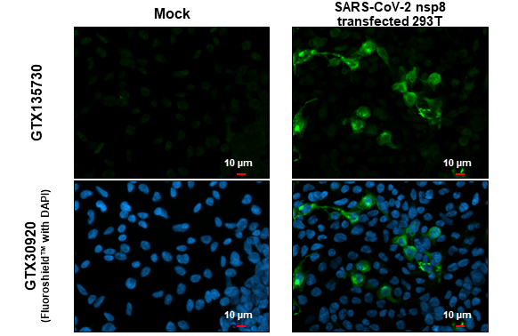SARS-CoV-2 (COVID-19) nsp8 antibody detects SARS-CoV-2 (COVID-19) nsp8 protein at cytoplasm by immunofluorescent analysis. Sample: Mock and transfected transfected 293T cells were fixed in 4% paraformaldehyde at RT for 15 min. Green: SARS-CoV-2 (COVID-19) nsp8 stained by SARS-CoV-2 (COVID-19) nsp8 antibody (GTX135730) diluted at 1:2000.