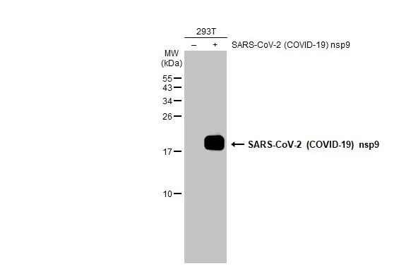 Non-transfected (-) and transfected (+) 293T whole cell extracts (30 microg) were separated by 15% SDS-PAGE, and the membrane was blotted with SARS-CoV-2 (COVID-19) nsp9 antibody (GTX135731) diluted at 1:5000. The HRP-conjugated anti-rabbit IgG antibody (GTX213110-01) was used to detect the primary antibody.