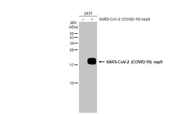 Non-transfected (–) and transfected (+) 293T whole cell extracts (30 μg) were separated by 15% SDS-PAGE, and the membrane was blotted with SARS-CoV-2 (COVID-19) nsp9 antibody (GTX135731) diluted at 1:5000. The HRP-conjugated anti-rabbit IgG antibody (GTX213110-01) was used to detect the primary antibody.