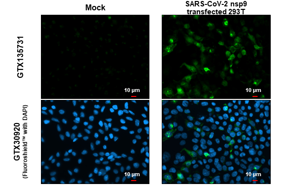 SARS-CoV-2 (COVID-19) nsp9 antibody detects SARS-CoV-2 (COVID-19) nsp9 protein at cytoplasm by immunofluorescent analysis. Sample: Mock and transfected transfected 293T cells were fixed in 4% paraformaldehyde at RT for 15 min. Green: SARS-CoV-2 (COVID-19) nsp9 stained by SARS-CoV-2 (COVID-19) nsp9 antibody (GTX135731) diluted at 1:2000.