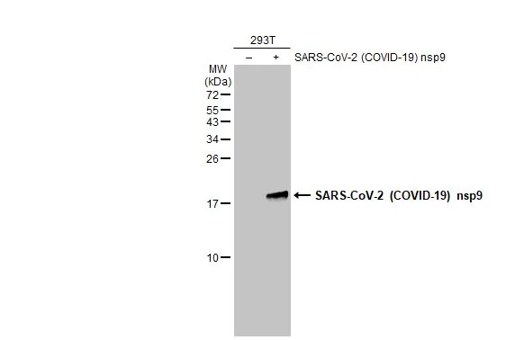 Non-transfected (-) and transfected (+) 293T whole cell extracts (30 microg) were separated by 15% SDS-PAGE, and the membrane was blotted with SARS-CoV-2 (COVID-19) nsp9 antibody (GTX135732) diluted at 1:5000. The HRP-conjugated anti-rabbit IgG antibody (GTX213110-01) was used to detect the primary antibody.