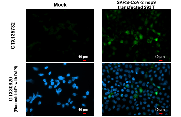 SARS-CoV-2 (COVID-19) nsp9 antibody detects SARS-CoV-2 (COVID-19) nsp9 protein at cytoplasm by immunofluorescent analysis. Sample: Mock and transfected transfected 293T cells were fixed in 4% paraformaldehyde at RT for 15 min. Green: SARS-CoV-2 (COVID-19) nsp9 stained by SARS-CoV-2 (COVID-19) nsp9 antibody (GTX135732) diluted at 1:2000.