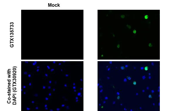 SARS-CoV-2 (COVID-19) nsp10 antibody detects SARS-CoV-2 (COVID-19) nsp10 protein at cytoplasm by immunohistochemical analysis. Sample: Mock (GTX435670) and SARS-CoV-2 (COVID-19) nsp10 transfected 293T cell FFPE Cell Pellet Block. Green: SARS-CoV-2 (COVID-19) nsp10 stained by SARS-CoV-2 (COVID-19) nsp10 antibody (GTX135733) diluted at 1:1000. Blue: Fluoroshield with DAPI (GTX30920). Antigen Retrieval: Citrate buffer, pH 6.0, 15 min