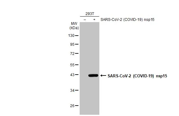 Non-transfected (-) and transfected (+) 293T whole cell extracts (30 microg) were separated by 10% SDS-PAGE, and the membrane was blotted with SARS-CoV-2 (COVID-19) nsp15 antibody (GTX135737) diluted at 1:5000. The HRP-conjugated anti-rabbit IgG antibody (GTX213110-01) was used to detect the primary antibody.