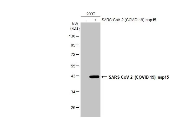 Non-transfected (–) and transfected (+) 293T whole cell extracts (30 μg) were separated by 10% SDS-PAGE, and the membrane was blotted with SARS-CoV-2 (COVID-19) nsp15 antibody (GTX135737) diluted at 1:5000. The HRP-conjugated anti-rabbit IgG antibody (GTX213110-01) was used to detect the primary antibody.