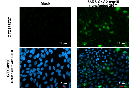 SARS-CoV-2 (COVID-19) nsp15 antibody detects SARS-CoV-2 (COVID-19) nsp15 protein at cytoplasm by immunofluorescent analysis. Sample: Mock and transfected transfected 293T cells were fixed in 4% paraformaldehyde at RT for 15 min. Green: SARS-CoV-2 (COVID-19) nsp15 stained by SARS-CoV-2 (COVID-19) nsp15 antibody (GTX135737) diluted at 1:2000.