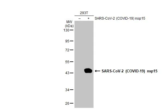 Non-transfected (-) and transfected (+) 293T whole cell extracts (30 microg) were separated by 10% SDS-PAGE, and the membrane was blotted with SARS-CoV-2 (COVID-19) nsp15 antibody (GTX135738) diluted at 1:5000. The HRP-conjugated anti-rabbit IgG antibody (GTX213110-01) was used to detect the primary antibody.