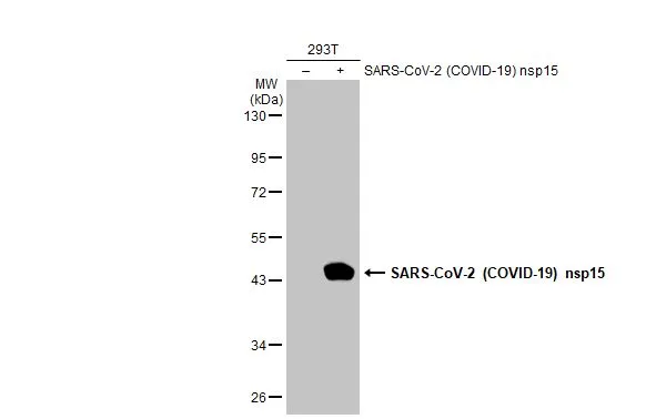 Non-transfected (–) and transfected (+) 293T whole cell extracts (30 μg) were separated by 10% SDS-PAGE, and the membrane was blotted with SARS-CoV-2 (COVID-19) nsp15 antibody (GTX135738) diluted at 1:5000. The HRP-conjugated anti-rabbit IgG antibody (GTX213110-01) was used to detect the primary antibody.