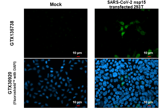 SARS-CoV-2 (COVID-19) nsp15 antibody detects SARS-CoV-2 (COVID-19) nsp15 protein at cytoplasm by immunofluorescent analysis. Sample: Mock and transfected transfected 293T cells were fixed in 4% paraformaldehyde at RT for 15 min. Green: SARS-CoV-2 (COVID-19) nsp15 stained by SARS-CoV-2 (COVID-19) nsp15 antibody (GTX135738) diluted at 1:2000.