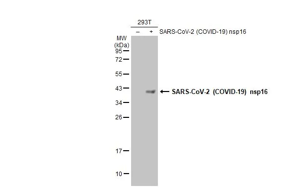 Non-transfected (–) and transfected (+) 293T whole cell extracts (30 μg) were separated by 12% SDS-PAGE, and the membrane was blotted with SARS-CoV-2 (COVID-19) nsp16 antibody (GTX135739) diluted at 1:5000. The HRP-conjugated anti-rabbit IgG antibody (GTX213110-01) was used to detect the primary antibody.