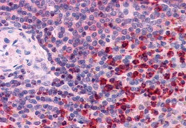 IHC-P analysis of human spleen using GTX13574 TrxR1 antibody, C-term. Antigen retrieval : citrate buffer pH 6 Dilution : 2.5microg/ml