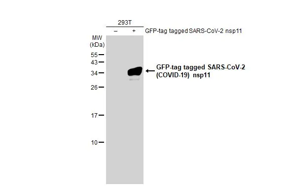 Non-transfected (–) and transfected (+) 293T whole cell extracts (30 μg) were separated by 15% SDS-PAGE, and the membrane was blotted with SARS-CoV-2 (COVID-19) nsp11 antibody (GTX135742) diluted at 1:5000. The HRP-conjugated anti-rabbit IgG antibody (GTX213110-01) was used to detect the primary antibody.