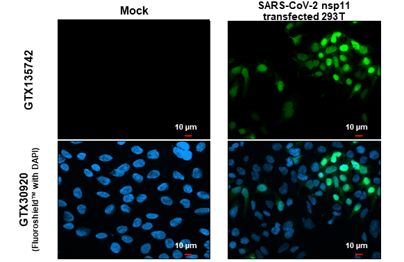 SARS-CoV-2 (COVID-19) nsp11 antibody detects SARS-CoV-2 (COVID-19) nsp11 protein at cytoplasm by immunofluorescent analysis. Sample: Mock and transfected transfected 293T cells were fixed in 4% paraformaldehyde at RT for 15 min. Green: SARS-CoV-2 (COVID-19) nsp11 stained by SARS-CoV-2 (COVID-19) nsp11 antibody (GTX135742) diluted at 1:2000.