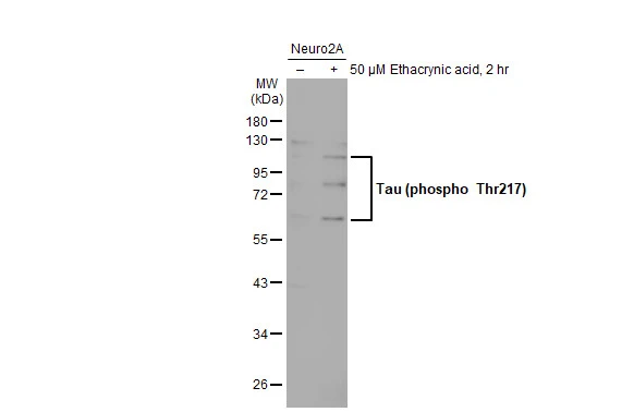 Untreated (–) and treated (+) Neuro2A whole cell extracts (30 μg) were separated by 10% SDS-PAGE, and the membrane was blotted with Tau (phospho Thr217) antibody (GTX135775) diluted at 1:3000. The HRP-conjugated anti-rabbit IgG antibody (GTX213110-01) was used to detect the primary antibody.