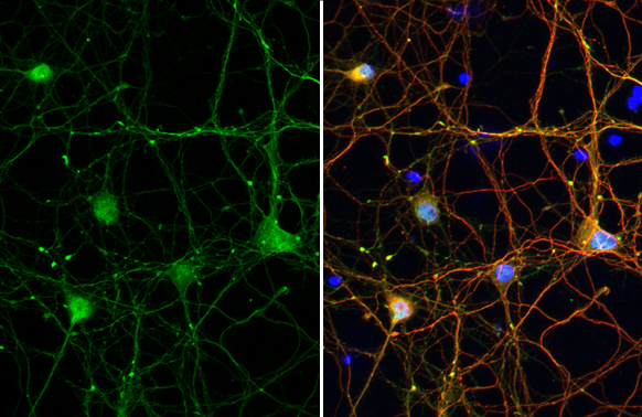 Taujan (タウジャン) pulse-21 Anti-Tau (phospho Thr217) antibody (GTX135775) | GeneTex