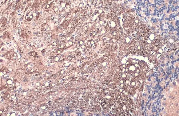 Tau (phospho Thr181) antibody detects Tau (phospho Thr181) protein at cell membrane and cytoplasm by immunohistochemical analysis. Sample: Paraffin-embedded mouse brain. Tau (phospho Thr181) stained by Tau (phospho Thr181) antibody (GTX135776) diluted at 1:500. Antigen Retrieval: Citrate buffer, pH 6.0, 15 min