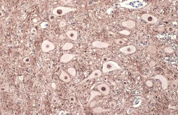 Tau (phospho Thr181) antibody detects Tau (phospho Thr181) protein at cell membrane and cytoplasm by immunohistochemical analysis. Sample: Paraffin-embedded rat brain. Tau (phospho Thr181) stained by Tau (phospho Thr181) antibody (GTX135776) diluted at 1:500. Antigen Retrieval: Citrate buffer, pH 6.0, 15 min