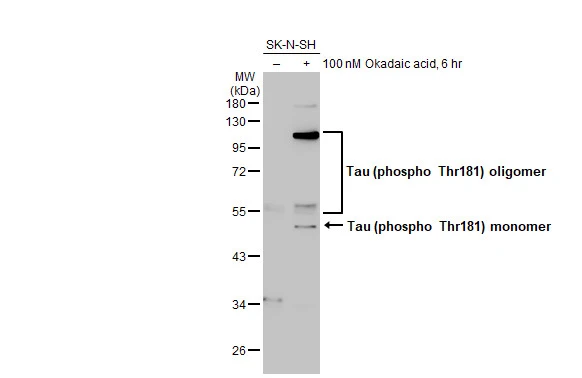 Untreated (–) and treated (+) SK-N-SH whole cell extracts (50 μg) were separated by 10% SDS-PAGE, and the membrane was blotted with Tau (phospho Thr181) antibody (GTX135776) diluted at 1:500. The HRP-conjugated anti-rabbit IgG antibody (GTX213110-01) was used to detect the primary antibody.
