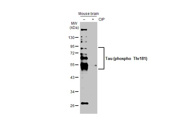 Untreated (–) and treated (+) Mouse tissue extracts (50 μg) were separated by 10% SDS-PAGE, and the membrane was blotted with Tau (phospho Thr181) antibody (GTX135776) diluted at 1:500. The HRP-conjugated anti-rabbit IgG antibody (GTX213110-01) was used to detect the primary antibody.