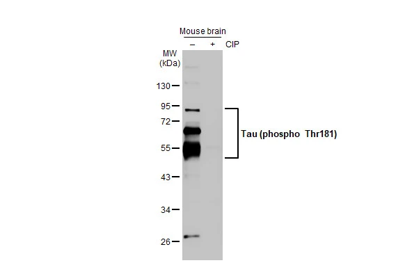 Anti-Tau (phospho Thr181) antibody (GTX135776) | GeneTex