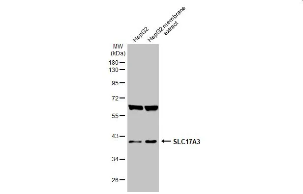 HepG2 whole cell and membrane extracts (30 μg) were separated by 10% SDS-PAGE, and the membrane was blotted with SLC17A3 antibody (GTX135781) diluted at 1:1000. The HRP-conjugated anti-rabbit IgG antibody (GTX213110-01) was used to detect the primary antibody.