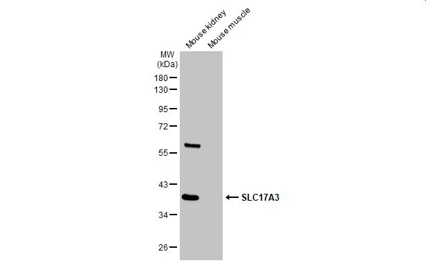 Various tissue extracts (30 μg) were separated by 10% SDS-PAGE, and the membrane was blotted with SLC17A3 antibody (GTX135781) diluted at 1:1000. The HRP-conjugated anti-rabbit IgG antibody (GTX213110-01) was used to detect the primary antibody.