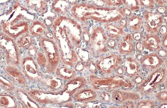 SLC17A3 antibody detects SLC17A3 protein at cell membrane and cytoplasm by immunohistochemical analysis. Sample: Paraffin-embedded rat kidney. SLC17A3 stained by SLC17A3 antibody (GTX135781) diluted at 1:500. Antigen Retrieval: Citrate buffer, pH 6.0, 15 min
