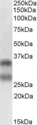 WB analysis of human lymph node tissue lysate (in RIPA buffer) using GTX13582 sRANKL antibody [12A668]. Loading : 35ug Dilution : 0.5 ug/ml