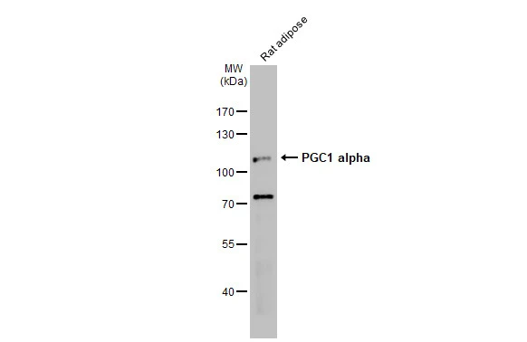 Rat tissue extract (50 μg) was separated by 7.5% SDS-PAGE, and the membrane was blotted with PGC1 alpha antibody (GTX135859) diluted at 1:1000. The HRP-conjugated anti-rabbit IgG antibody (GTX213110-01) was used to detect the primary antibody.
