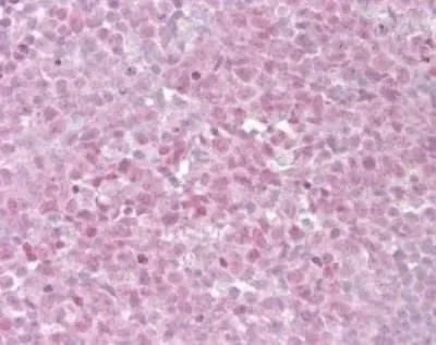IHC-P analysis of human tonsil tissue using GTX13589 TRF2 antibody. Dilution : 15 microg/ml IHC-P analysis of human tonsil tissue using GTX13589 TRF2 antibody. Dilution : 15 microg/ml