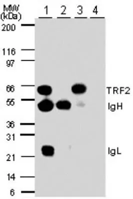 IP analysis of HL-60 cell lysate using GTX13589 TRF2 antibody. Lane 1 : IP with mouse anti-TRF2 antibody Lane 2 : IP with control mouse IgG Lane 3 : IP with goat anti-TRF2 antibody (GTX13589) Lane 4 : IP with pre-immune goat IgG