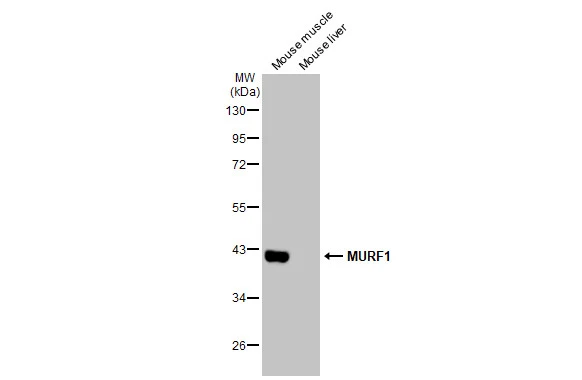 Various tissue extracts (50 μg) were separated by 10% SDS-PAGE, and the membrane was blotted with MURF1 antibody (GTX135929) diluted at 1:1000. The HRP-conjugated anti-rabbit IgG antibody (GTX213110-01) was used to detect the primary antibody.
