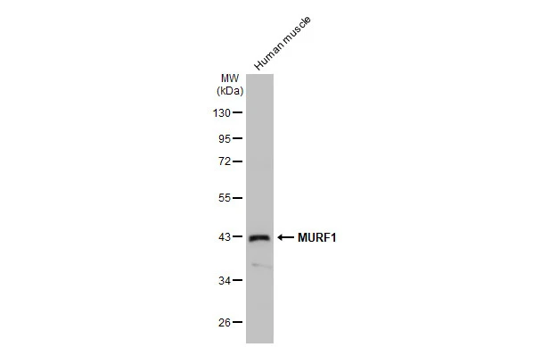 Human tissue extract (30 μg) was separated by 10% SDS-PAGE, and the membrane was blotted with MURF1 antibody (GTX135929) diluted at 1:1000. The HRP-conjugated anti-rabbit IgG antibody (GTX213110-01) was used to detect the primary antibody.