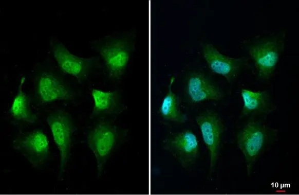 MURF1 antibody detects MURF1 protein at nucleus, cytoplasm and endoplasmic reticulum by immunofluorescent analysis. Sample: HeLa cells were fixed in 4% paraformaldehyde at RT for 15 min. Green: MURF1 stained by MURF1 antibody (GTX135929) diluted at 1:500. Blue: Fluoroshield with DAPI (GTX30920).