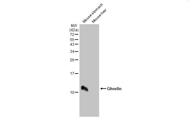 Various tissue extracts (50 μg) were separated by 15% SDS-PAGE, and the membrane was blotted with Ghrelin antibody (GTX135930) diluted at 1:1000. The HRP-conjugated anti-rabbit IgG antibody (GTX213110-01) was used to detect the primary antibody.