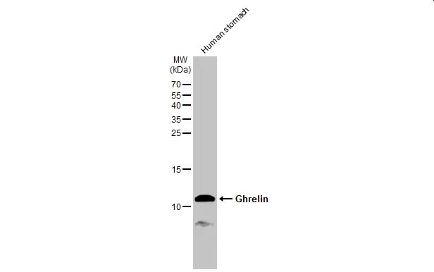 Human tissue extract (30 μg) was separated by 15% SDS-PAGE, and the membrane was blotted with Ghrelin antibody (GTX135930) diluted at 1:1000. The HRP-conjugated anti-rabbit IgG antibody (GTX213110-01) was used to detect the primary antibody.