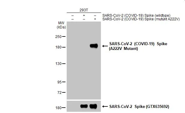 Non-transfected (-) and transfected (+) 293T whole cell extracts (30 microg) were separated by 5% SDS-PAGE, and the membrane was blotted with SARS-CoV-2 (COVID-19) Spike (A222V Mutant) antibody (GTX135960) diluted at 1:5000. The HRP-conjugated anti-rabbit IgG antibody (GTX213110-01) was used to detect the primary antibody.