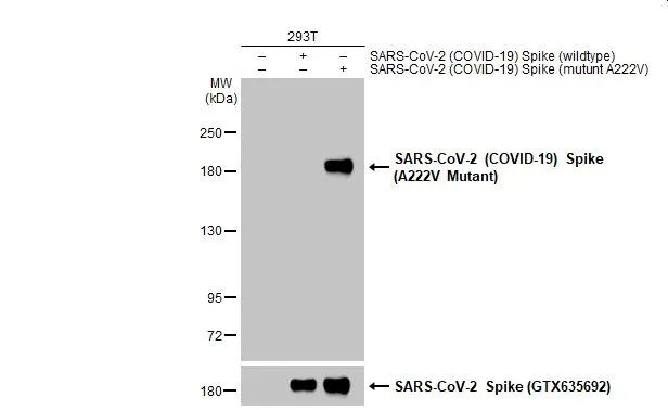Non-transfected (–) and transfected (+) 293T whole cell extracts (30 μg) were separated by 5% SDS-PAGE, and the membrane was blotted with SARS-CoV-2 (COVID-19) Spike (A222V Mutant) antibody (GTX135960) diluted at 1:5000. The HRP-conjugated anti-rabbit IgG antibody (GTX213110-01) was used to detect the primary antibody.