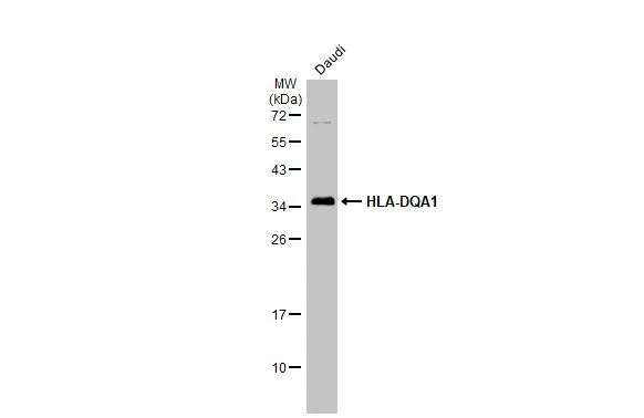 Whole cell extract (30 microg) was separated by 12% SDS-PAGE, and the membrane was blotted with HLA-DQA1 antibody (GTX135986) diluted at 1:1000. The HRP-conjugated anti-rabbit IgG antibody (GTX213110-01) was used to detect the primary antibody.