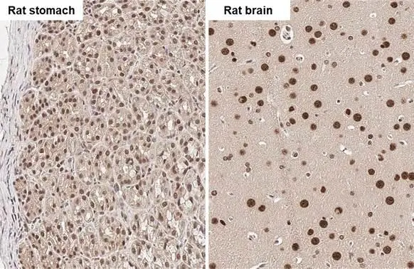 hnRNP G antibody detects hnRNP G protein by immunohistochemical analysis. Sample: Paraffin-embedded rat tissues. hnRNP G stained by hnRNP G antibody (GTX135993) diluted at 1:500. Antigen Retrieval: Citrate buffer, pH 6.0, 15 min