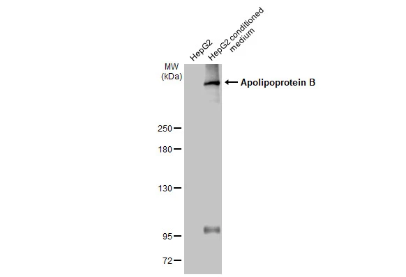 HepG2 whole cell extract and conditioned medium (30 μg) were separated by 5% SDS-PAGE, and the membrane was blotted with Apolipoprotein B antibody (GTX135994) diluted at 1:1000. The HRP-conjugated anti-rabbit IgG antibody (GTX213110-01) was used to detect the primary antibody.