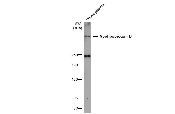 Mouse plasma (30 μg) was separated by 5% SDS-PAGE, and the membrane was blotted with Apolipoprotein B antibody (GTX135994) diluted at 1:1000. The HRP-conjugated anti-rabbit IgG antibody (GTX213110-01) was used to detect the primary antibody.