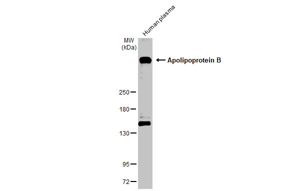Human plasma (30 μg) was separated by 5% SDS-PAGE, and the membrane was blotted with Apolipoprotein B antibody (GTX135994) diluted at 1:1000. The HRP-conjugated anti-rabbit IgG antibody (GTX213110-01) was used to detect the primary antibody.