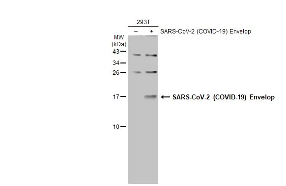 Non-transfected (-) and transfected (+) 293T whole cell extracts (30 microg) were separated by 15% SDS-PAGE, and the membrane was blotted with SARS-CoV-2 (COVID-19) Envelop antibody (GTX136046) diluted at 1:1000. The HRP-conjugated anti-rabbit IgG antibody (GTX213110-01) was used to detect the primary antibody.
